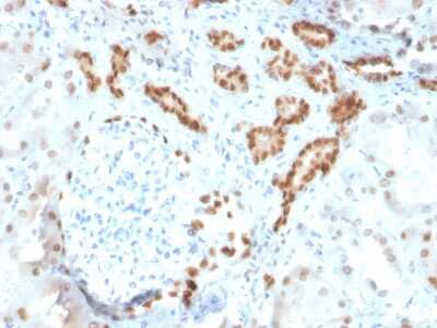 PAX8 Antibody (ZR-1)