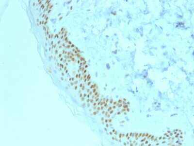 p63/TP73L Antibody (TP63/2428)