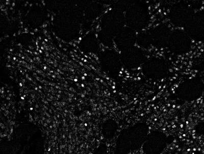 Cyclin E1 Antibody (CCNE1/2460)