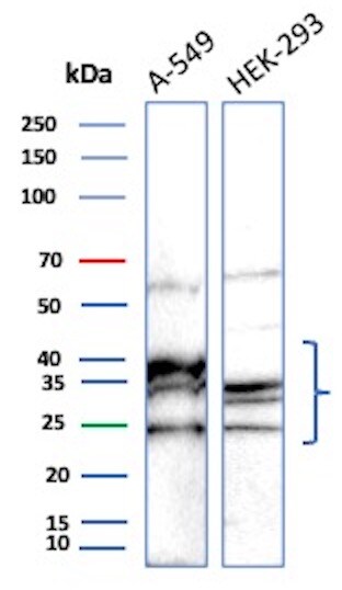 UBE2R1/CDC34 Antibody (CPTC-CDC34-2) Western Blot: UBE2R1/CDC34 Antibody (CPTC-CDC34-2) [NBP3-07514] -