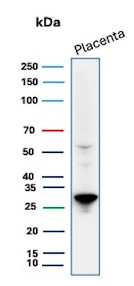 PDLIM1 Antibody (CPTC-PDLIM1-1) Western Blot: PDLIM1 Antibody (CPTC-PDLIM1-1) [NBP3-07518] -