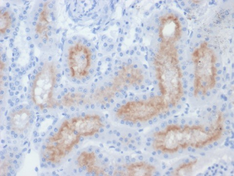 PSMA/FOLH1/NAALADase I Antibody (FOLH1/2354)