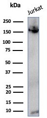 TOP2A Antibody (TOP2A/4397R)