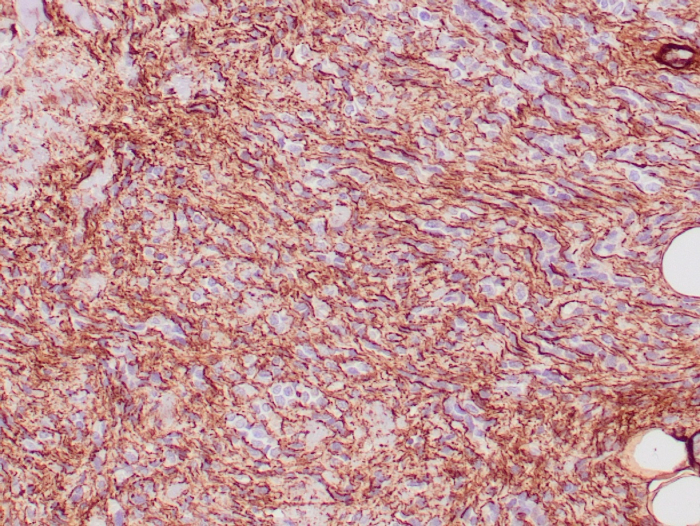 Collagen IV Antibody (COL4/4241R)