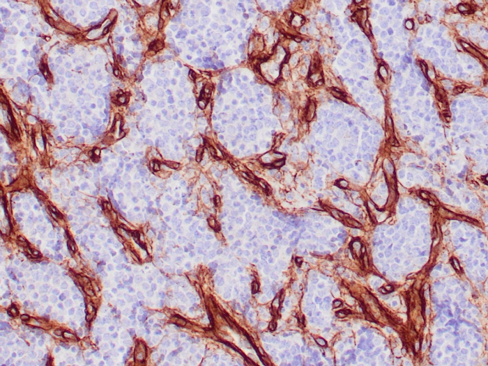 Collagen IV Antibody (COL4/4241R)