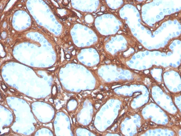 Collagen IV Antibody (COL4/4241R)