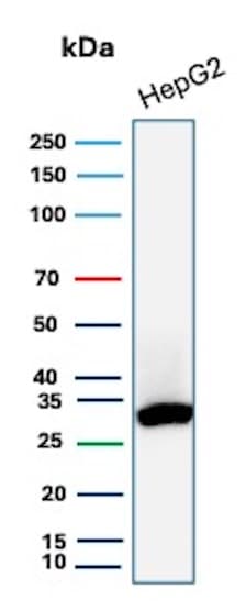 SDHB Antibody (SDHB/2382) Western Blot: SDHB Antibody (SDHB/2382) [NBP3-07787] -