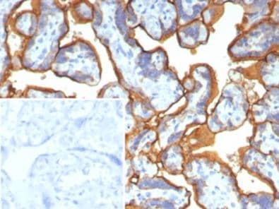Alkaline Phosphatase/ALPP Antibody (ALPP/2899R)