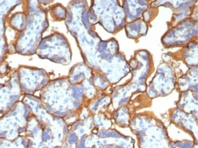 Alkaline Phosphatase/ALPP Antibody (ALPP/2899R)