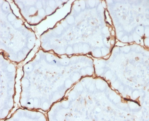 ACE/CD143 Antibody (9B9)