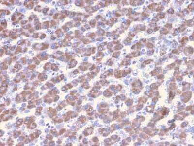 Prohibitin Antibody (PHB/3228)
