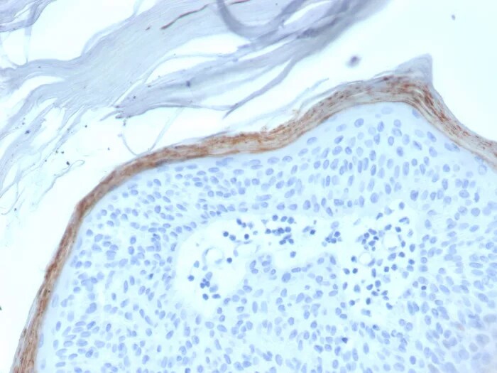 Kallikrein 5 Antibody (KLK5/3845) Immunohistochemistry-Paraffin: Kallikrein 5 Antibody (KLK5/3845) [NBP3-07860] -