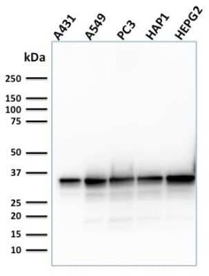 APE Antibody (CPTC-APEX1-2)