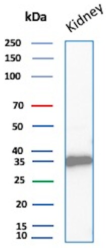 Napsin A Antibody (NAPSA/1865R) Western Blot: Napsin A Antibody (NAPSA/1865R) [NBP3-07870] -
