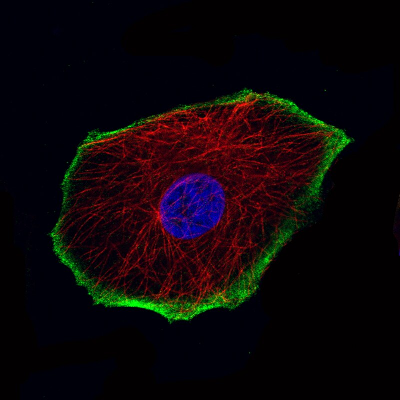 TRPM4 Antibody (CL11214) - BSA Free Immunocytochemistry/ Immunofluorescence: TRPM4 Antibody (CL11214) [NBP3-07990]