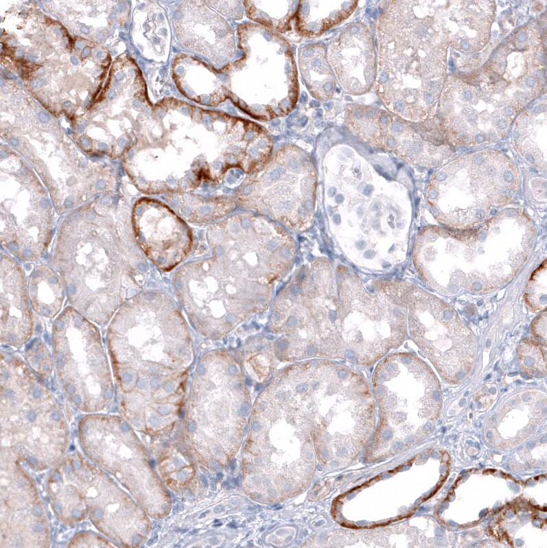 TRPM4 Antibody (CL11214) - BSA Free Immunohistochemistry-Paraffin: TRPM4 Antibody (CL11214) [NBP3-07990]