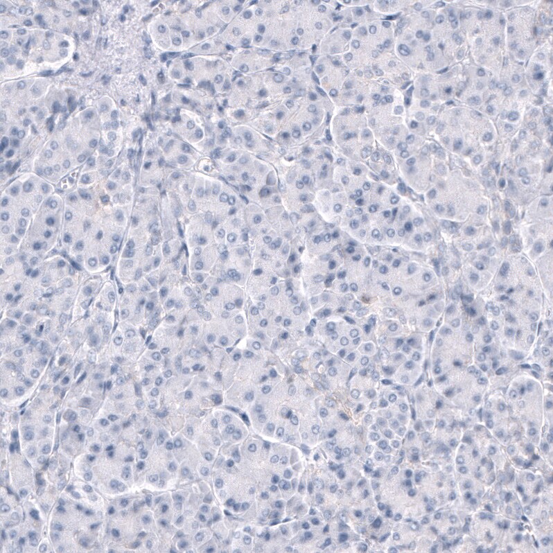 TRPM4 Antibody (CL11214) - BSA Free Immunohistochemistry-Paraffin: TRPM4 Antibody (CL11214) [NBP3-07990]