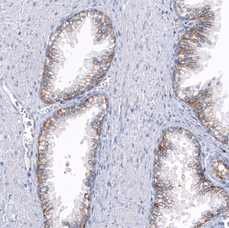 TRPM4 Antibody (CL11214) - BSA Free Immunohistochemistry-Paraffin: TRPM4 Antibody (CL11214) [NBP3-07990]