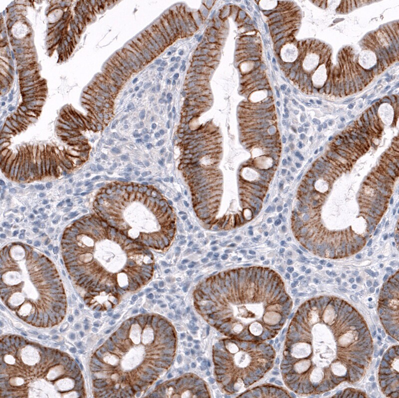 TRPM4 Antibody (CL11214) - BSA Free Immunohistochemistry-Paraffin: TRPM4 Antibody (CL11214) [NBP3-07990]