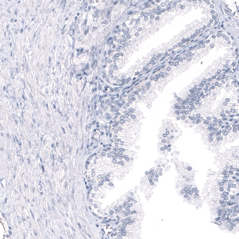 GPR17 Antibody (CL10474) - BSA Free Immunohistochemistry-Paraffin: GPR17 Antibody (CL10474) [NBP3-07993]
