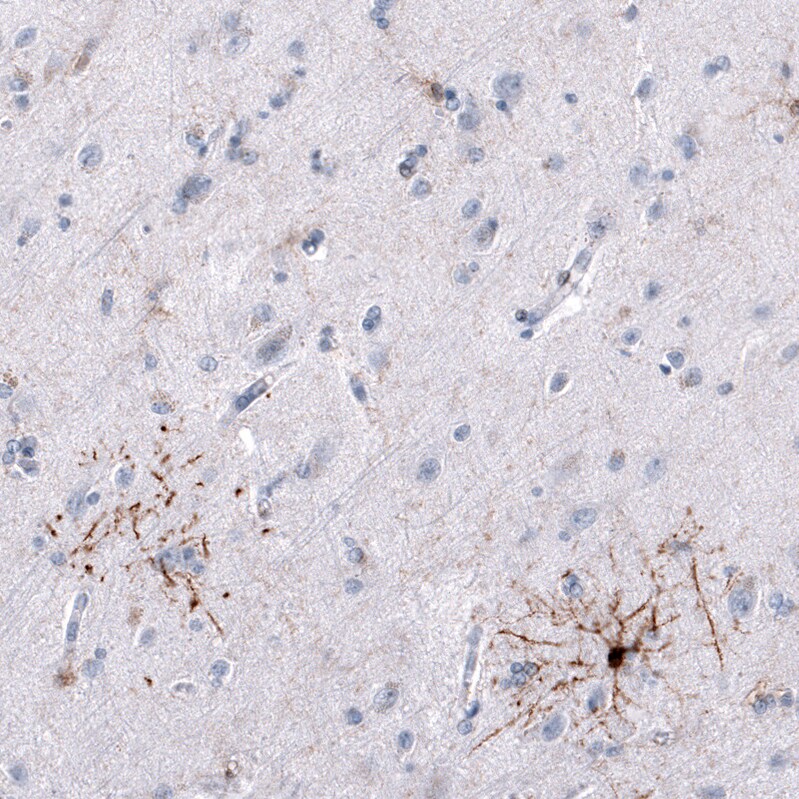 GPR17 Antibody (CL10474) - BSA Free Immunohistochemistry-Paraffin: GPR17 Antibody (CL10474) [NBP3-07993]