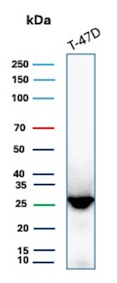GSTM3 Antibody (CPTC-GSTMu3-1) - Azide and BSA Free Western Blot: GSTM3 Antibody (CPTC-GSTMu3-1) - Azide and BSA Free [NBP3-08256] -