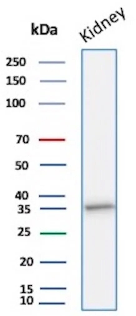 Napsin A Antibody (rNAPSA/1239) - Azide and BSA Free Western Blot: Napsin A Antibody (rNAPSA/1239) - Azide and BSA Free [NBP3-08374] -