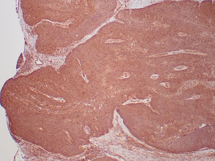 HPV16/HPV18 E6 Antibody (HPV16/1295 + HPV18/1297) - Azide and BSA Free HPV16/HPV18 E6 Antibody (HPV16/1295 + HPV18/1297) - Azide and BSA Free