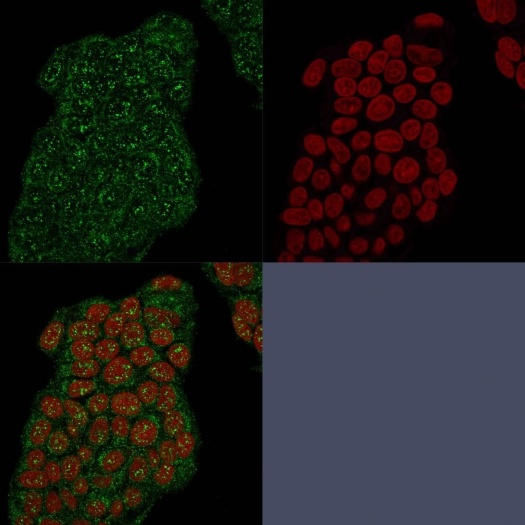 Mammaglobin A Antibody (MGB/2682R) - Azide and BSA Free Immunocytochemistry/ Immunofluorescence: Mammaglobin A Antibody (MGB/2682R) - Azide and BSA Free [NBP3-08525] -
