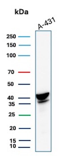 Serpin B3/SCCA1 Antibody (CPTC-SERPINB3-2) - Azide and BSA Free Western Blot: Serpin B3/SCCA1 Antibody (CPTC-SERPINB3-2) - Azide and BSA Free [NBP3-08536] -