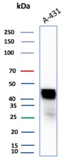 Cytokeratin 17 Antibody (KRT17/4604) - Azide and BSA Free Western Blot: Cytokeratin 17 Antibody (KRT17/4604) - Azide and BSA Free [NBP3-08541] -
