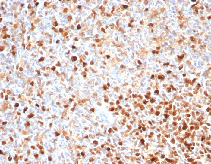 TOP2A Antibody (TOP2A/4397R) - Azide and BSA Free
