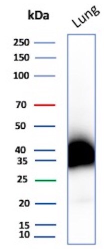 Podoplanin Antibody (PDPN/4009R) - Azide and BSA Free Western Blot: Podoplanin Antibody (PDPN/4009R) - Azide and BSA Free [NBP3-08816] -