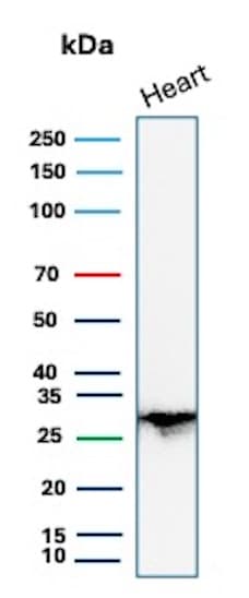 PDLIM1 Antibody (CPTC-PDLIM1-1) - Azide and BSA Free Western Blot: PDLIM1 Antibody (CPTC-PDLIM1-1) - Azide and BSA Free [NBP3-08842] -
