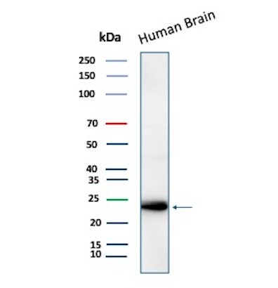 LMO2 Antibody (LMO2/3147R) - Azide and BSA Free Western Blot: LMO2 Antibody (LMO2/3147R) - Azide and BSA Free [NBP3-08945] -