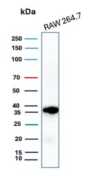 Cyclin D1 Antibody (CCND1/3370R) - Azide and BSA Free Western Blot: Cyclin D1 Antibody (CCND1/3370R) - Azide and BSA Free [NBP3-08955] -