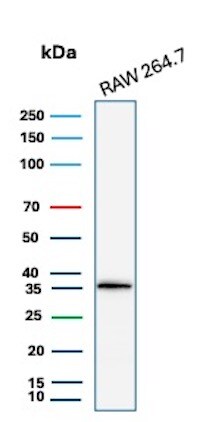 Cyclin D1 Antibody (CCND1/3370R) - Azide and BSA Free Western Blot: Cyclin D1 Antibody (CCND1/3370R) - Azide and BSA Free [NBP3-08955] -