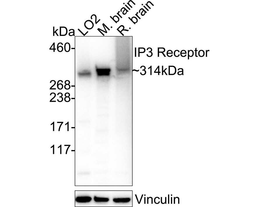 IP3R1 Antibody Western Blot: IP3R1 Antibody [NBP3-09066]