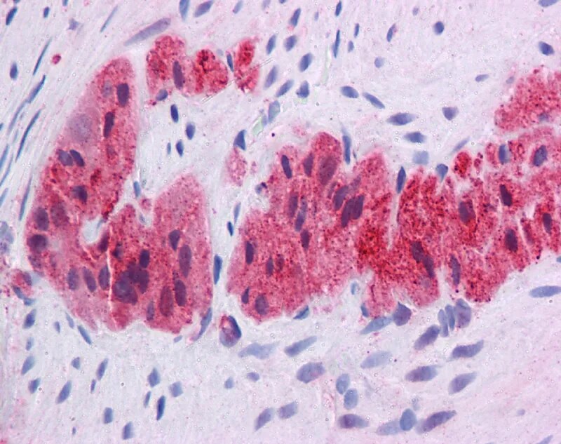 KLF2 Antibody