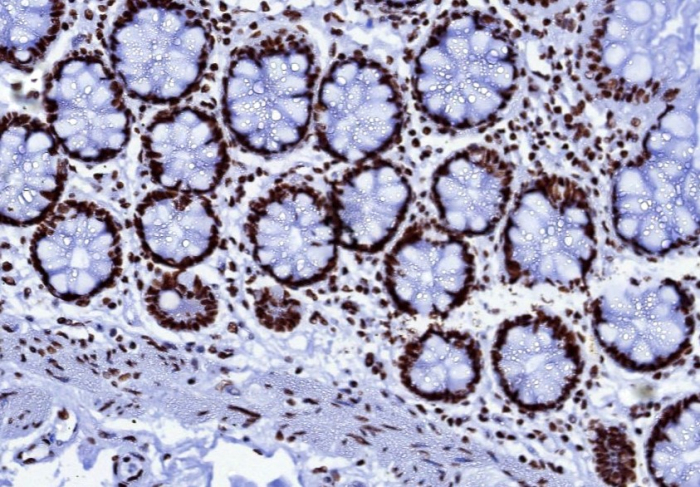 Nucleolin Antibody (NCL/7014R) - Azide and BSA Free