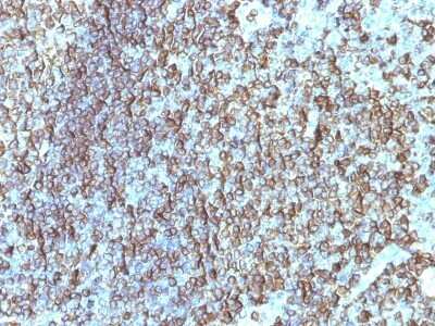HLA DRB1 Antibody (SPM288) - Azide and BSA Free Immunohistochemistry-Paraffin: HLA DRB1 Antibody (SPM288) - Azide and BSA Free [NBP3-11419] -