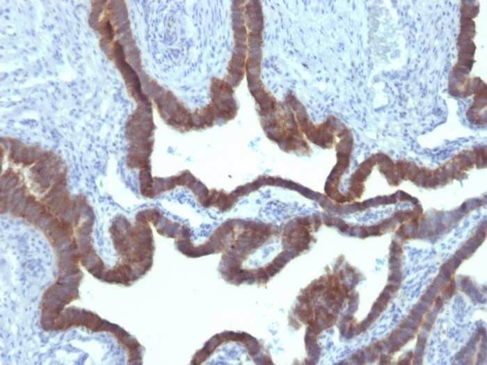 Cytokeratin 7 Antibody (KRT7/903) - Azide and BSA Free Immunohistochemistry-Paraffin: Cytokeratin 7 Antibody (KRT7/903) - Azide and BSA Free [NBP3-11426] -