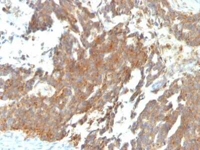 GnRHR Antibody (GNRHR/768) - Azide and BSA Free Immunohistochemistry-Paraffin: GnRHR Antibody (GNRHR/768) - Azide and BSA Free [NBP3-11436] -