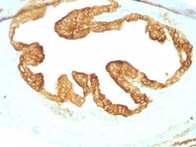 Cytokeratin, pan Antibody (KRTL/1077 + KRTH/1076) - Azide and BSA Free Immunohistochemistry-Paraffin: Cytokeratin, pan Antibody (KRTL/1077 + KRTH/1076) - Azide and BSA Free [NBP3-11443] -