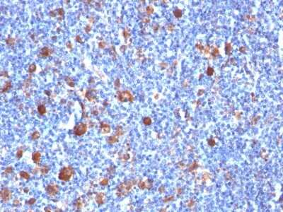 Fascin Antibody (SPM133) - Azide and BSA Free Immunohistochemistry-Paraffin: Fascin Antibody (SPM133) - Azide and BSA Free [NBP3-11444] -