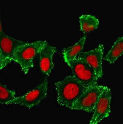 CD44 Antibody (DF1485) - Azide and BSA Free Immunocytochemistry/ Immunofluorescence: CD44 Antibody (DF1485) - Azide and BSA Free [NBP3-11454] -