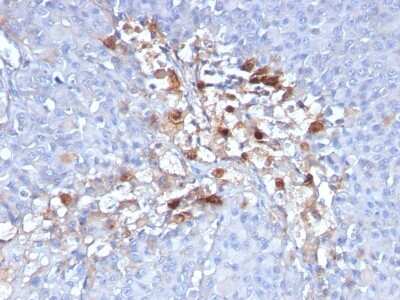MCAM/CD146 Antibody (C146/634) - Azide and BSA Free Immunohistochemistry-Paraffin: MCAM/CD146 Antibody (C146/634) - Azide and BSA Free [NBP3-11467] -