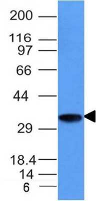 CD74 Antibody (CLIP/1133) - Azide and BSA Free Western Blot: CD74 Antibody (CLIP/1133) - Azide and BSA Free [NBP3-11486] -