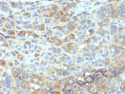 ICAM-1/CD54 Antibody (W-CAM-1 (same as Wehi-CAM-1 or 1H4)) - Azide and BSA Free Immunohistochemistry-Paraffin: ICAM-1/CD54 Antibody (W-CAM-1 (same as Wehi-CAM-1 or 1H4)) - Azide and BSA Free [NBP3-11490] -