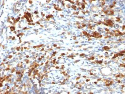 CD79A Antibody (IGA/764) - Azide and BSA Free Immunohistochemistry-Paraffin: CD79A Antibody (IGA/764) - Azide and BSA Free [NBP3-11494] -